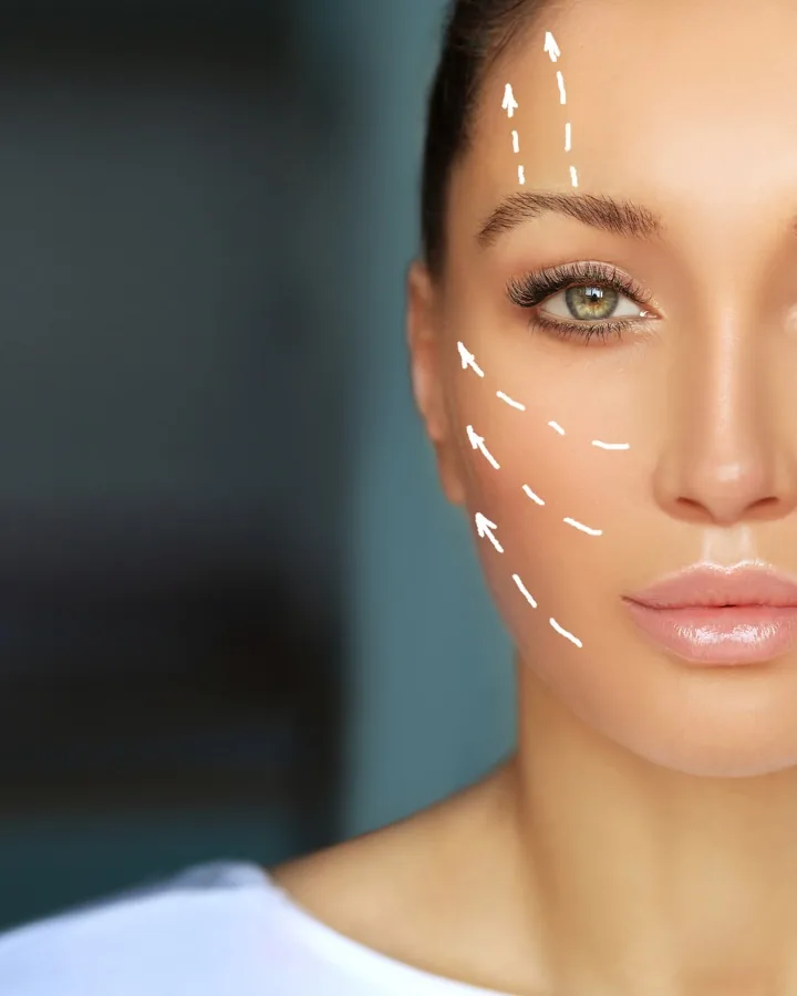 Lifting facial Deep Plane e Deep Neck